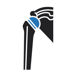 Post-operative Rehabilitation
